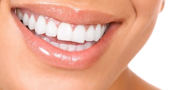 FACCETTE DI CERAMICA PER DENTI PERFETTI